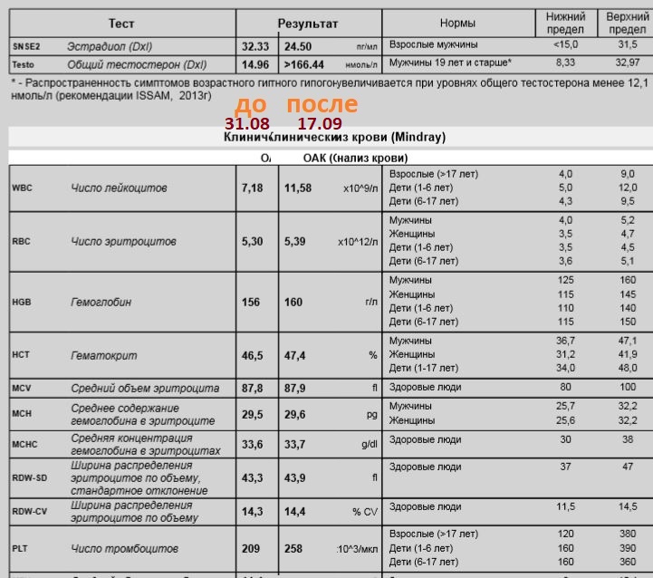 АНАБОЛИКИ.net - оф.дилер SP, Zerox, Genetic, Magnus, Lyka ! - Бодибилдинг форум AnabolicShops